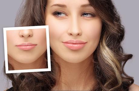 women with full plump lips from fillers